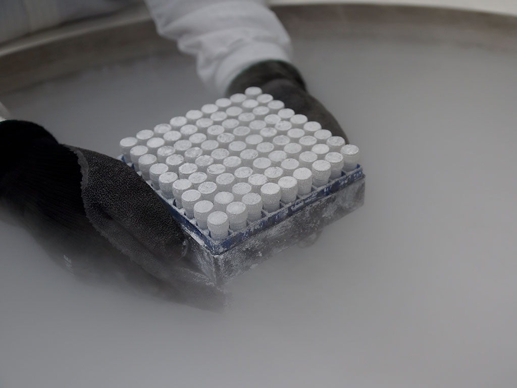 細胞凍存 細胞凍存